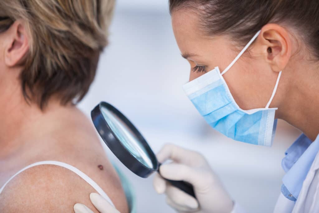 Dermatologist examining mole of female patient with magnifying glass in clinic during a skin cancer screening.